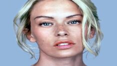 Cilt lekelerinden kurtulup pürüzsüz bir cilde kavuşmak mümkün