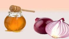 Bal – Limon Ve Soğan Mucizesi