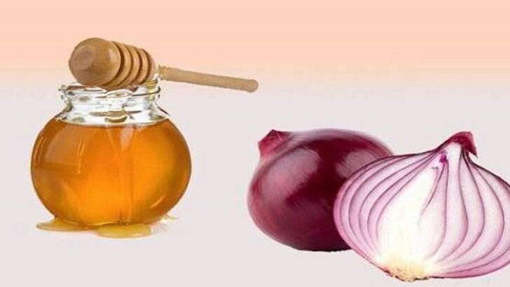 Bal – Limon Ve Soğan Mucizesi